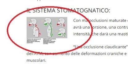 Postura e rialzi dei denti: un binomio e una “moda” che meccanicamente porta a conseguenze infelici. Lo sapevate?