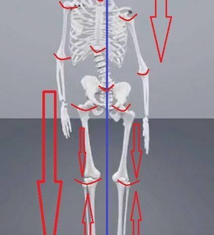 Un’articolazione consumata/rovinata (anche da traumi) guarisce anatomicamente e completamente solo se si è in equilibrio meccanico abituale del corpo