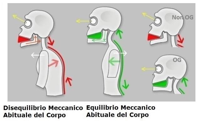 Il Recupero dell’Equilibrio Anatomico Abituale – CPT-OG