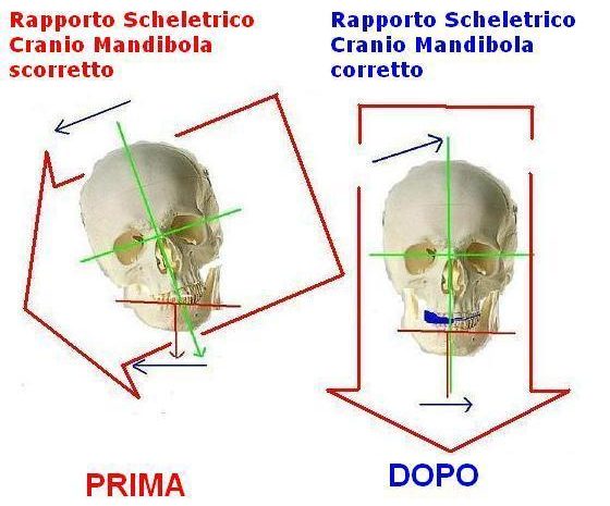 Ortodonzia, gnatologia e postura: si parte da “dogmi” sbagliati?