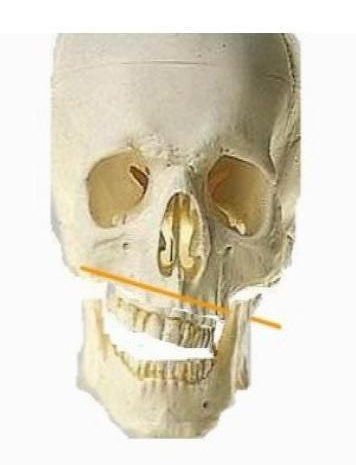 Denti dritti o ossa storte o entrambe le cose? Ortodonzia: quando è pericolosa per l’Equilibrio Meccanico Abituale del corpo umano?