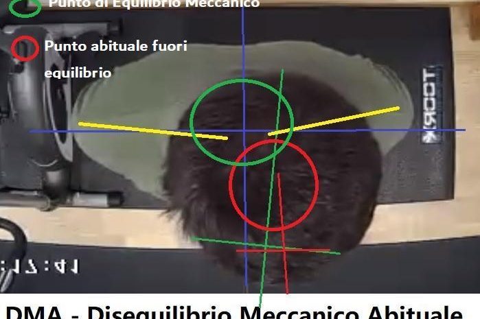 Malocclusione, bilanciamenti, filosofia, lato alto-lato basso….tutto sbagliato.