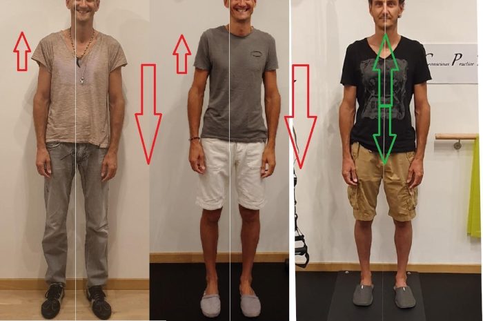 Perchè tutte le valutazioni posturali non sono scientifiche e non sono affidabili?