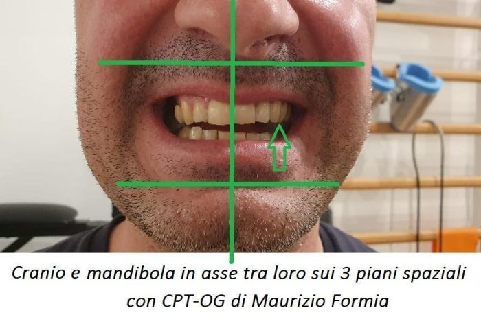 La mandibola come SOSTEGNO del cranio: il cambiamento di paradigma è ovvio