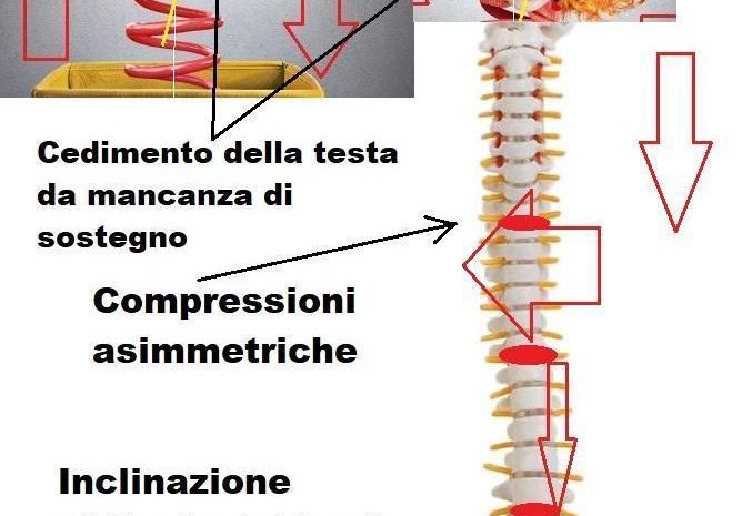 Il principio fisico meccanico che sostiene il corpo umano: cosa non avete capito medici e ricercatori che mi pubblicate abusivamente su Pub Med?