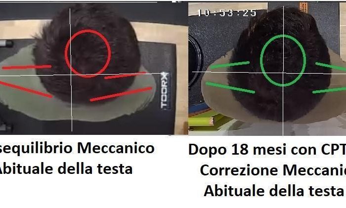 Quanto pesa la vostra testa? E se non è in asse sul corpo? Cambiamo Paradigma…