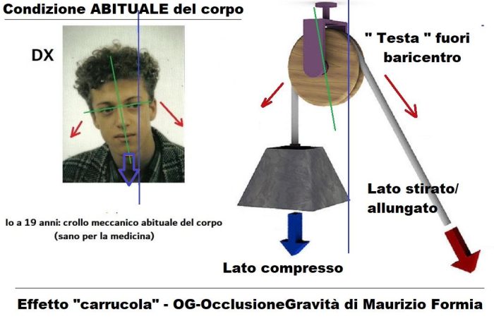 L’effetto “carrucola” sui tre assi spaziali: cambiamo paradigma sul funzionamento del corpo umano