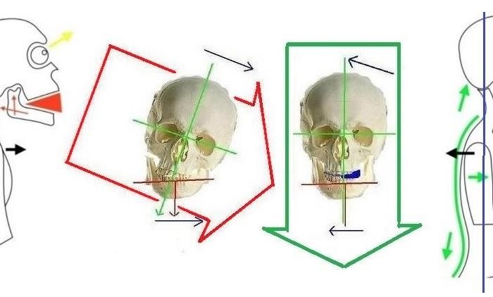 Si può vedere un Disequilibrio Meccanico Abituale del corpo con una pedana posturometrica o un esame posturologico? Assolutamente no.