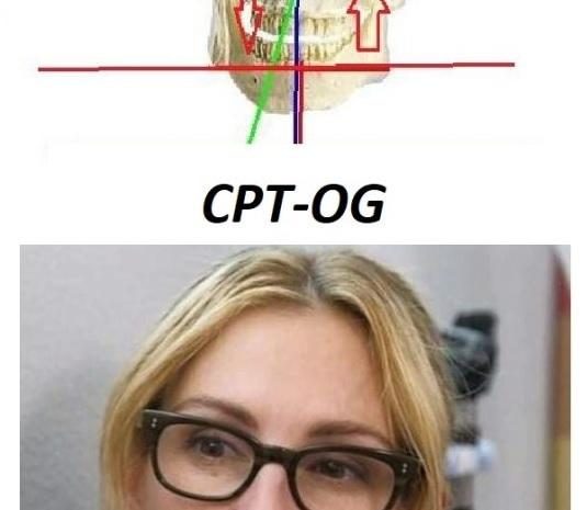 Si può riequilibrare la simmetria del corpo senza interventi chirurgici? Si. Si deve! Con il CPT-OG OcclusioneGravità