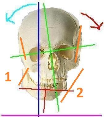 Differenze tra CPT-OG OcclusioneGravità e tutti i trattamenti posturali (con o senza Bite) – muscolari (con o senza Bite)