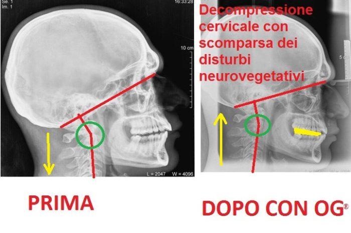 OG o US? Spesso diventiamo l'”U”ltima “S”piaggia a causa di pregiudizi e incompetenza da parte di sanitari e medici