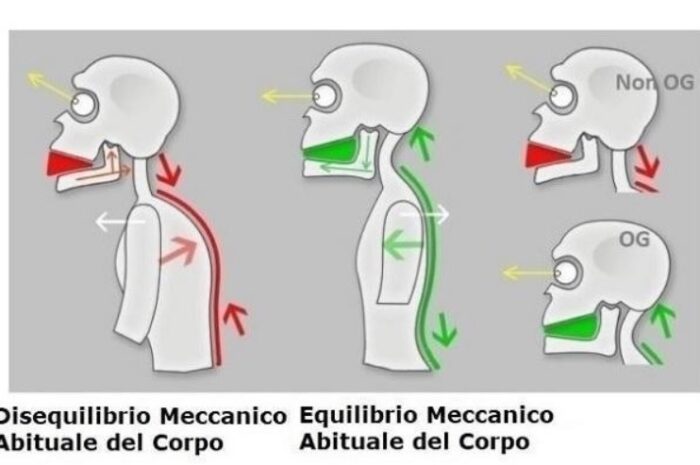 La nostra immagine famosa in tutto il mondo non descrive un problema odontoiatrico e nemmeno posturale.