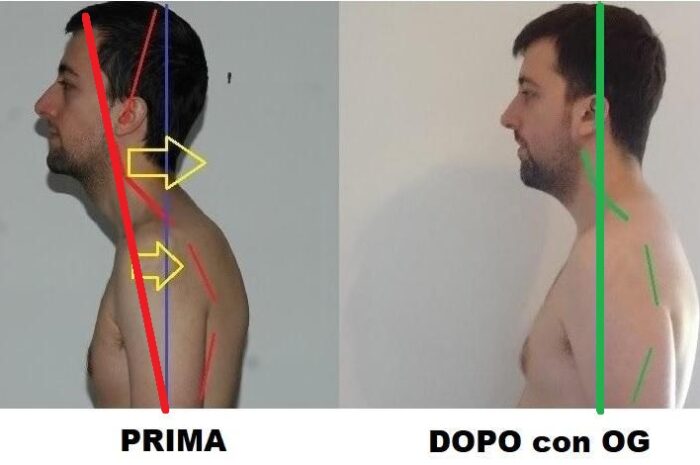 La redistribuzione della colonna vertebrale. Un principio fisico-meccanico sconosciuto a tutte le discipline esistenti, fondamentale per il benessere del corpo umano